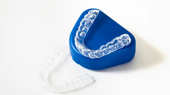 Chỉnh nha không mắc cài