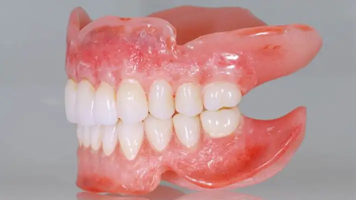 Răng tháo lắp Composite