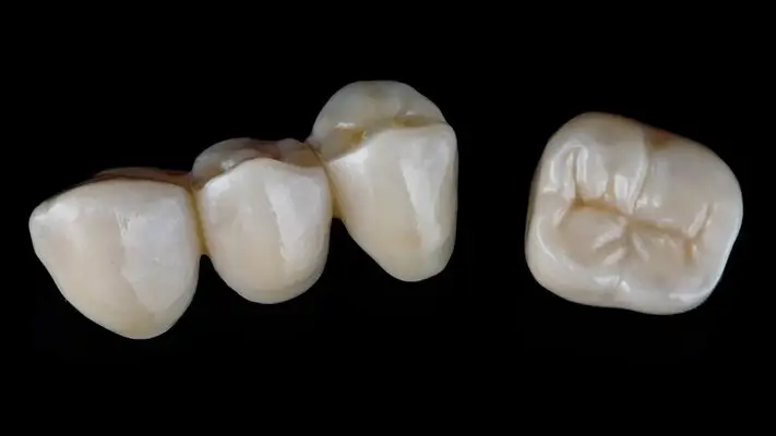 Răng toàn sứ Emax