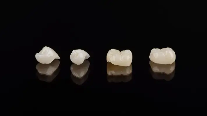 Răng toàn sứ Venus Multi