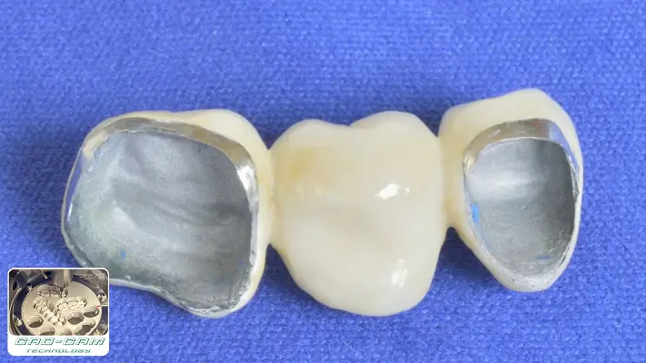 Răng sứ Titan Cad/Cam 2