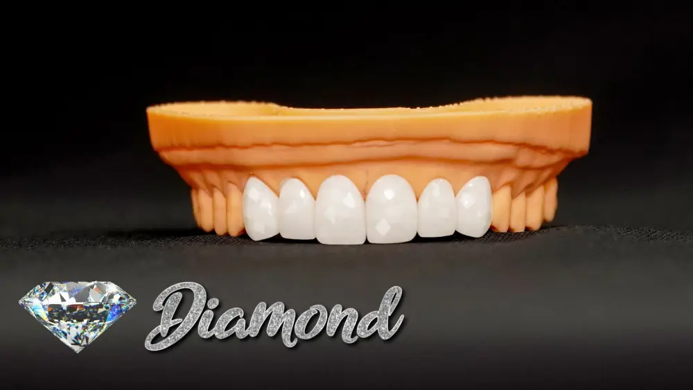 Răng toàn sứ Vera Diamond