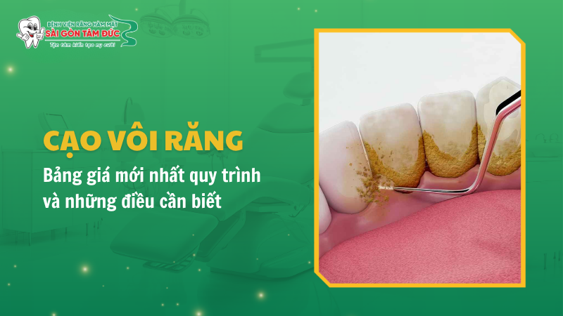 1thumb cao voi rang benhvienranghammatsaigontamduc