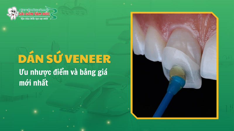 1thumb dan su veneer benhvienranghammatsaigontamduc