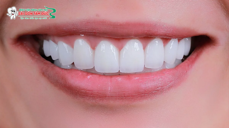 Những lợi ích vượt trội sau khi phẫu thuật chỉnh hàm
