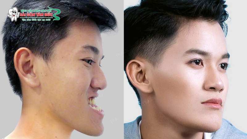 Những lợi ích vượt trội về sức khỏe và thẩm mỹ