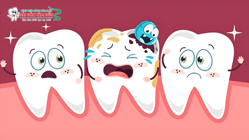 Thói quen vệ sinh răng miệng kém
