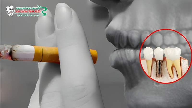 Thói quen hút thuốc lá thường xuyên