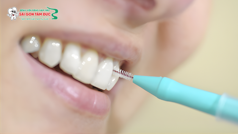 Cách chăm sóc và phòng ngừa viêm nha chu tại nhà