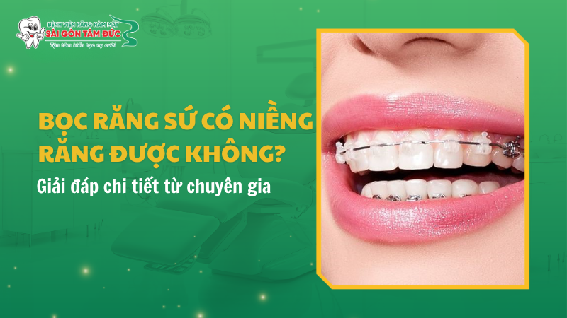Bọc răng sứ có niềng răng được không? Giải đáp chi tiết từ chuyên gia 1 boc rang su co nieng rang duoc khong 1