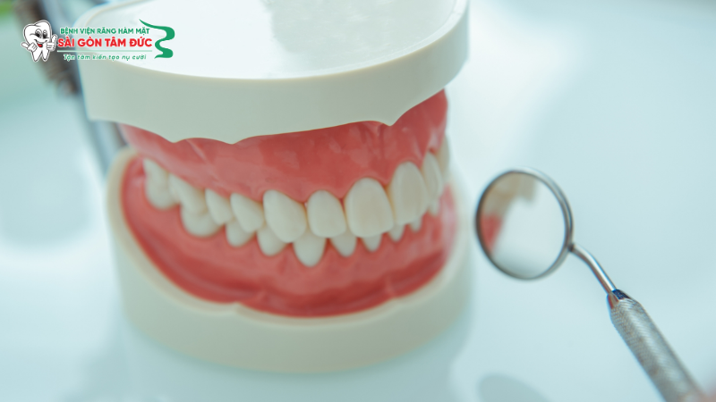 Bọc răng sứ có niềng răng được không? Giải đáp chi tiết từ chuyên gia 3 boc rang su co nieng rang duoc khong 3