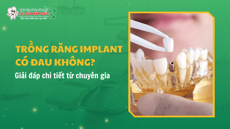 trong rang implant co dau khong 1