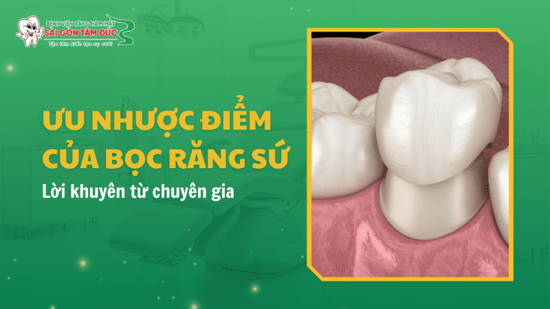 uu nhuoc diem cua boc rang su 1